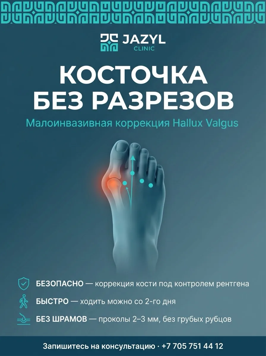 Косточка без разрезов — малоинвазивная коррекция Hallux Valgus в Jazyl Clinic